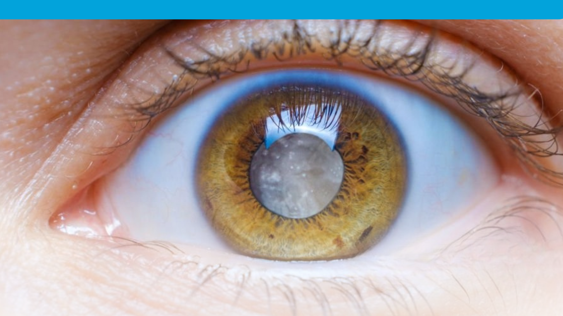 Prevenção e Diagnóstico Precoce